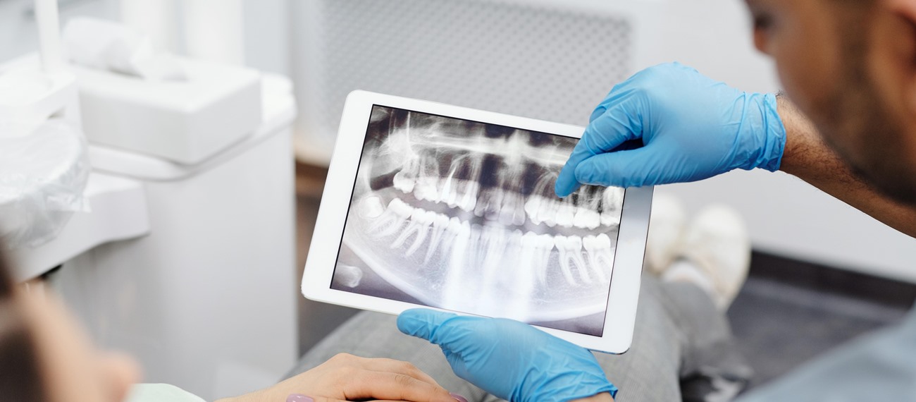 Sodyum Hipokloritin Klorheksidin ile Kazara Temasından Sonra Ne Oluşmaz?