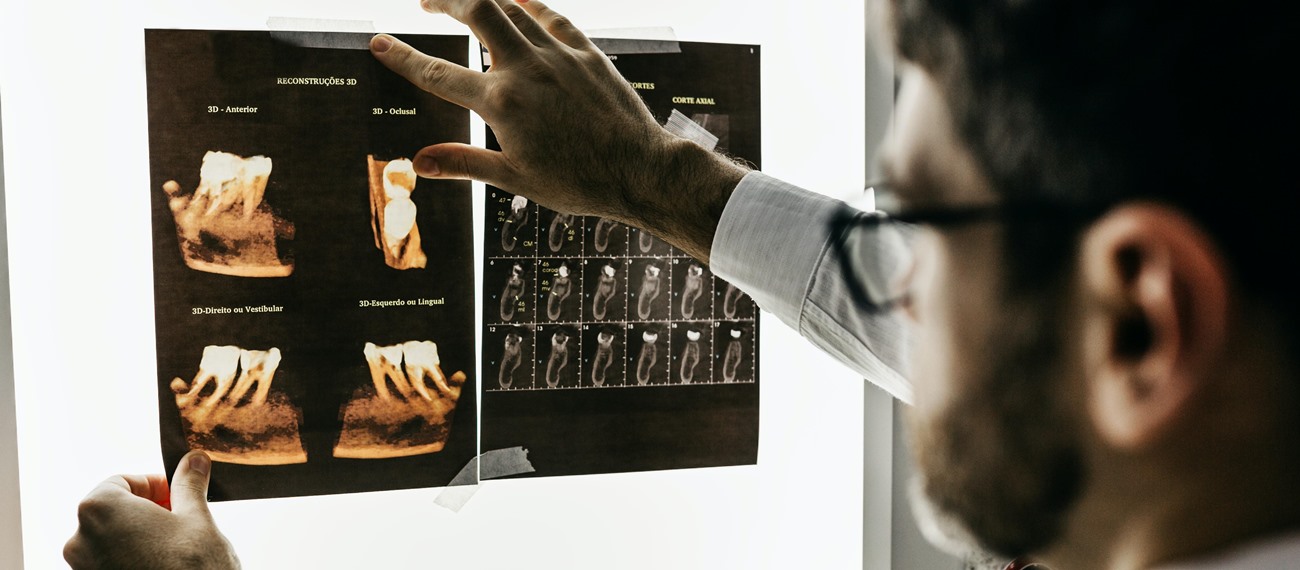 Kalsiyum Hidroksit Bazlı İlaçların İçsel Fizikokimyasal Etkileşimleri