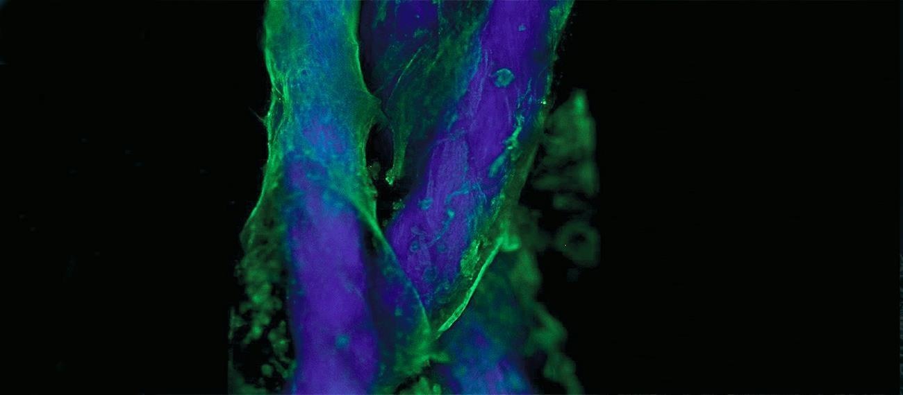 İskelet Kas Modellerinin Mühendisliğinde Canlı Kompozit Liflerin Kullanımı
